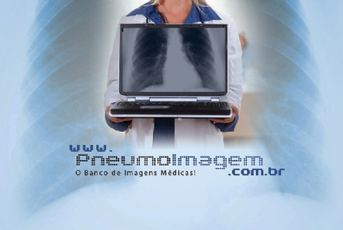 O PNEUMOIMAGEM ALCAN�A 2000 AMIGOS NO FACEBOOK